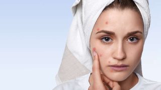 are pimple patches safe