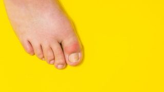 uric acid patients has to stay away from this pulse