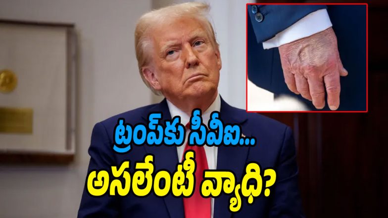 Donald-Trump-CVI