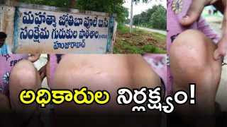Students Bitten By Tats(IMAGE credit: swetcha reporter)