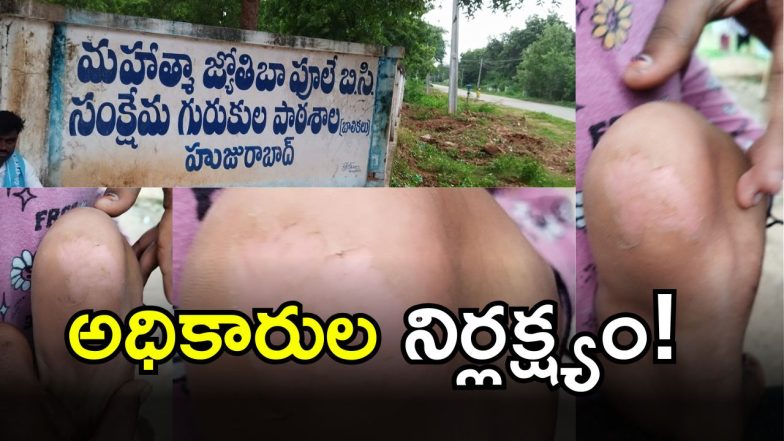 Students Bitten By Tats(IMAGE credit: swetcha reporter)