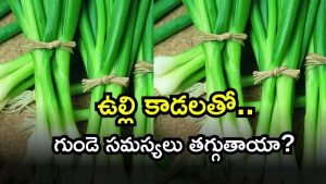 onions ( Image Source: Twitter)