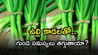 onions ( Image Source: Twitter)