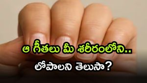 Body Deficiency ( Image Source: Twitter)