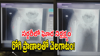 Hospital Negligence: తుని ఆసుపత్రిలో వైద్యుల నిర్లక్ష్యం.. కాలి లోపలే బ్లేడు మర్చిపోయిన ఘటన!