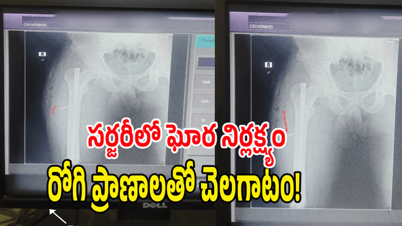 Hospital Negligence ( image Credit: swetcha reporter)