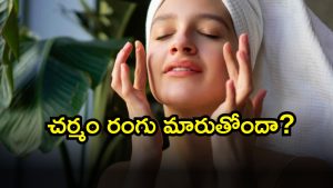 Skin ( Image Source: Twitter)