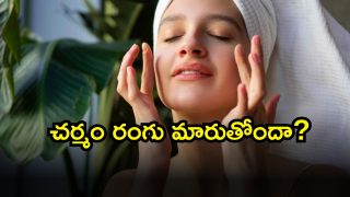 Skin ( Image Source: Twitter)