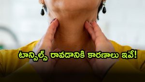 Tonsil Stones ( Image Source: Twitter)