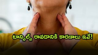 Tonsil Stones ( Image Source: Twitter)