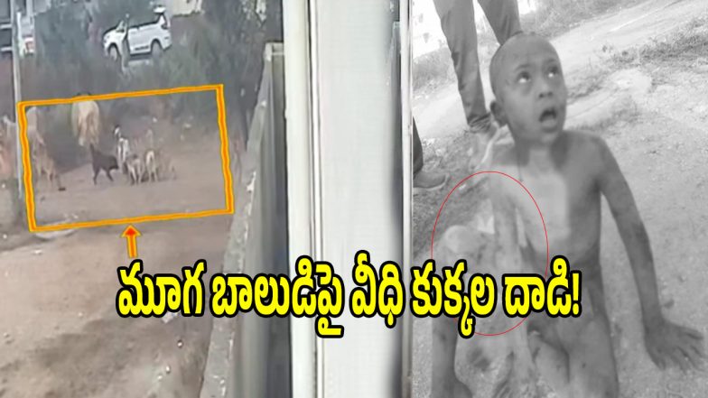 Stray Dog Attack (imagecredit:twitter)