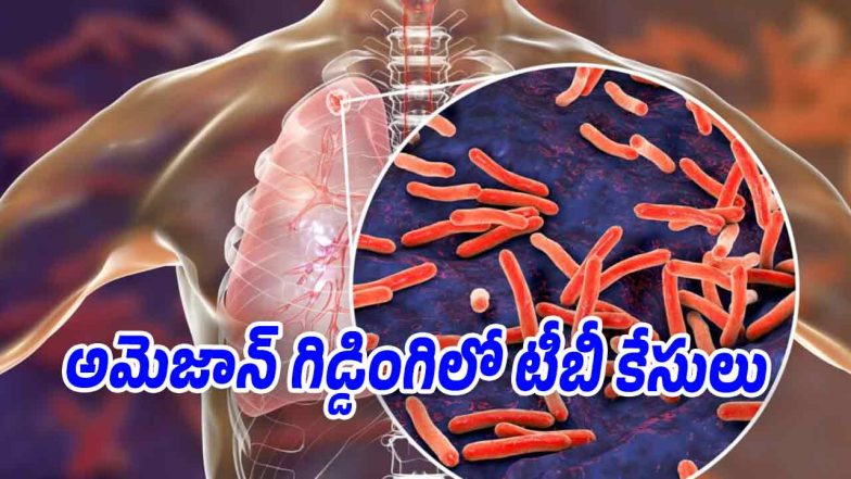 Illustration showing tuberculosis bacteria affecting human lungs